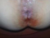 Comendo o cu dela até sangrar no anal